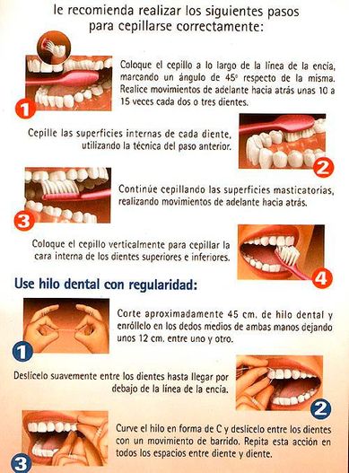 Guía limpieza dental
